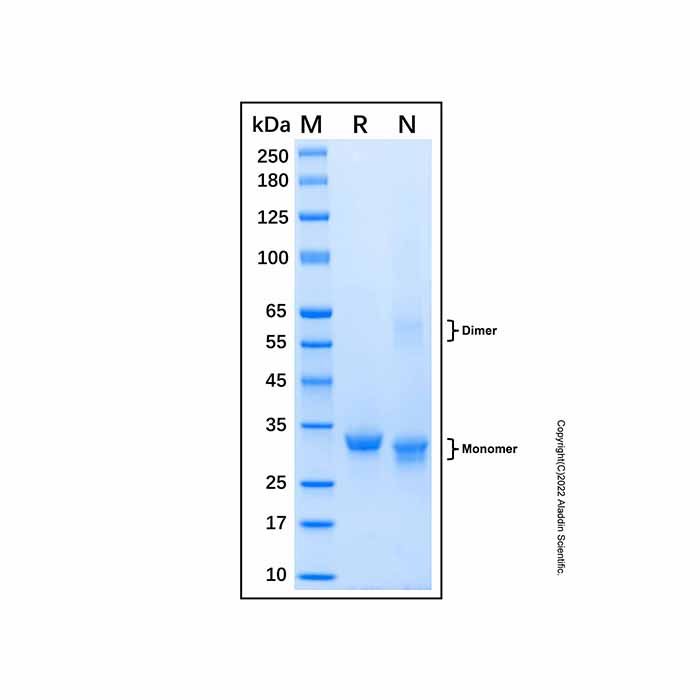 Recombinant Human Glycine N-methyltransferase/GNMT Protein