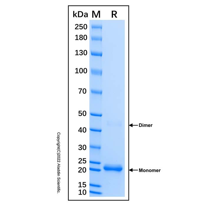 Recombinant Human RIPK3 Protein