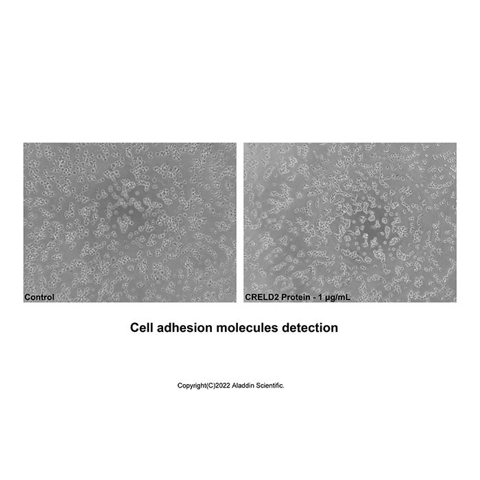 Recombinant Human CRELD2 Protein
