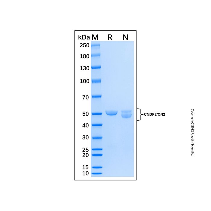 Recombinant Human CNDP2 Protein 