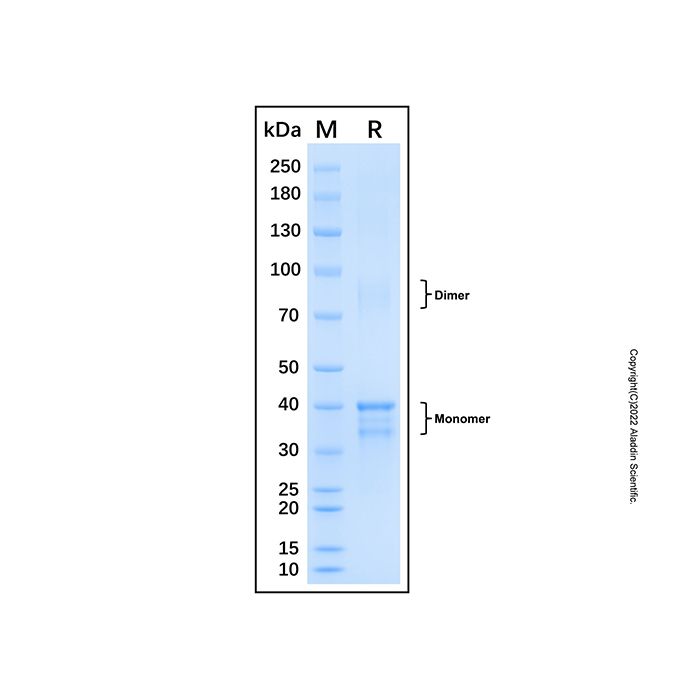 Recombinant Human Cdk9 Protein