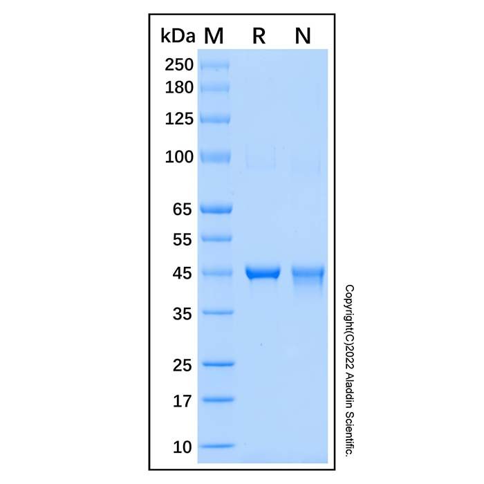 Recombinant Human ETNK2 Protein
