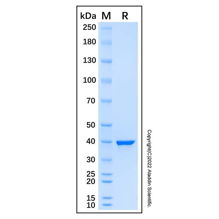 Recombinant Human RAD51B Protein