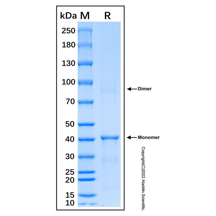 Recombinant Human RASSF1A Protein 