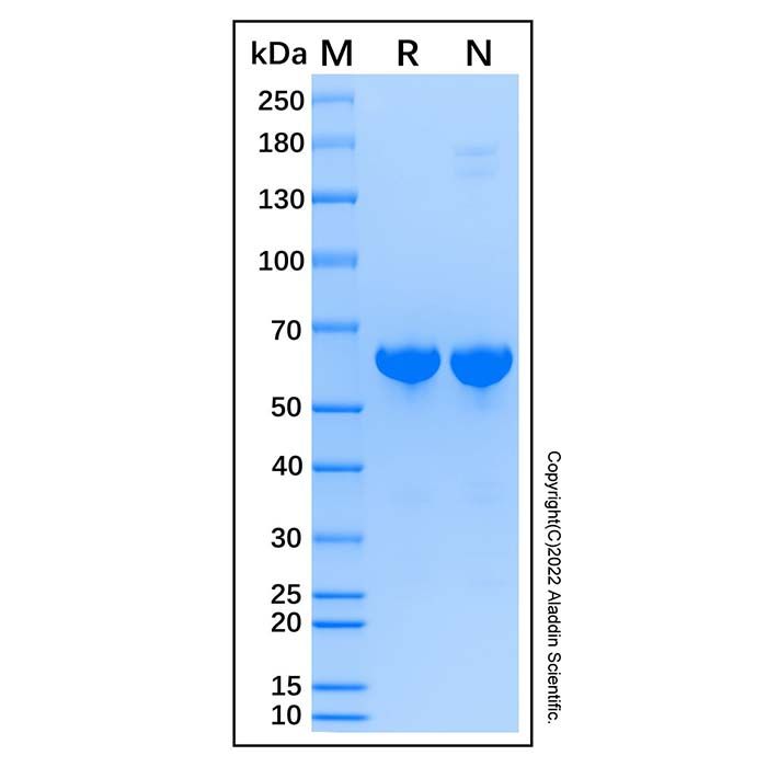 Recombinant Human Alkaline Phosphatase Protein