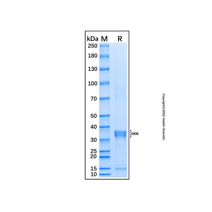 Recombinant Human IKK beta Protein