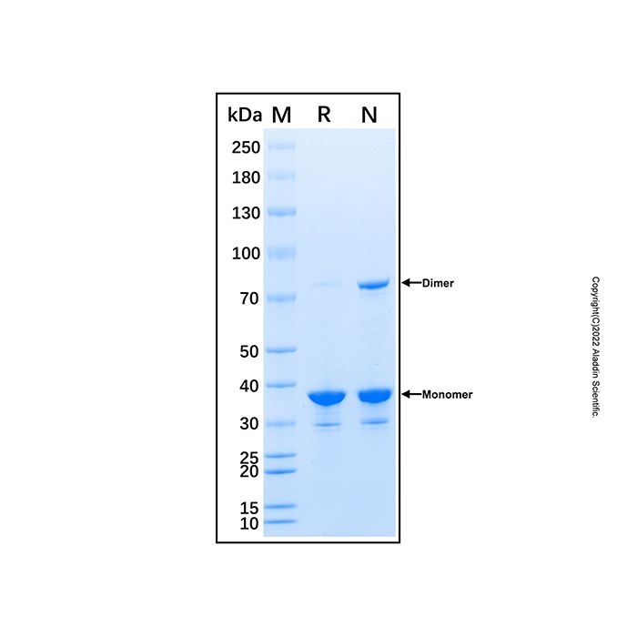 Recombinant Human ROCK1 Protein