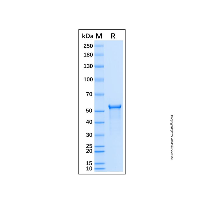 Recombinant Human Sphingosine Kinase 1/SPHK1 Protein