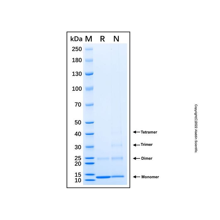 Recombinant Human CYP24A1 Protein