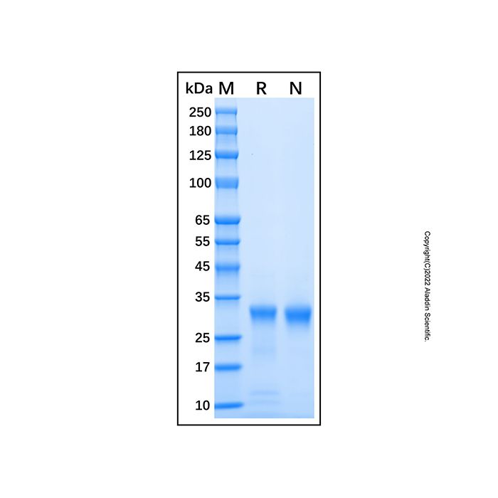 Recombinant Human Cathepsin L Protein