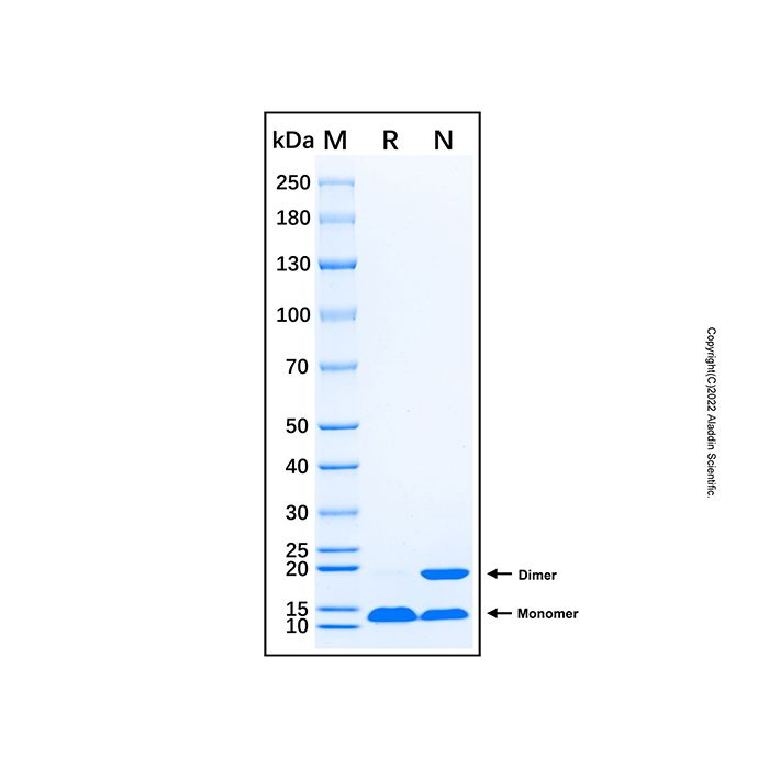 Recombinant Human AQP4 Protein