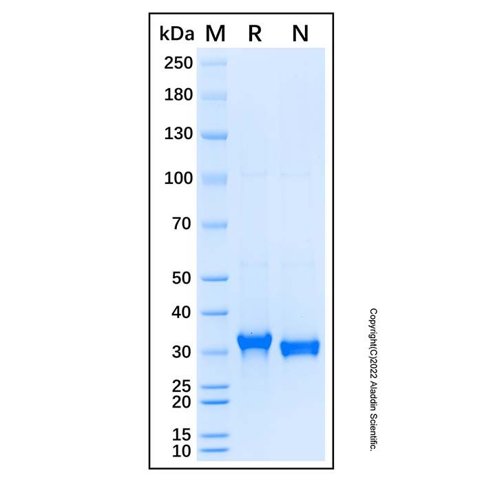Recombinant Human IBPL1 Protein