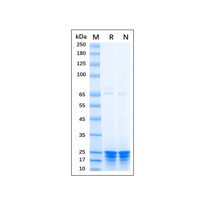 Recombinant Human TAGLN/Transgelin Protein