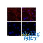 Goat Anti-Rabbit IgG H&L (TRITC)