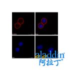 Goat Anti-Human IgG (TRITC)