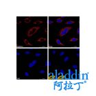 Goat Anti-Rabbit IgG H&L (TRITC)