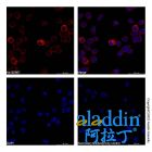 Goat Anti-Human IgG (AF647)