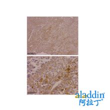Recombinant alpha 1 Fetoprotein Antibody