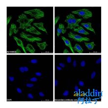 ICC/IF-Streptavidin protein (FITC) (rp155876)
ICC/IF with Streptavidin protein (FITC) (rp155876) stained HeLa cells. The cells were methanol fixed (5 min) and then incubated in 1% in 0.1% PBS-Tween for 1h to block non-specific protein-protein interaction