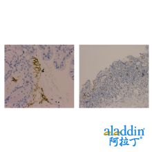Recombinant Helicobacter pylori Antibody