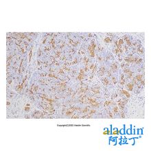 Recombinant CA19-9 Antibody