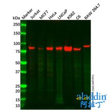 Recombinant CD168 Antibody