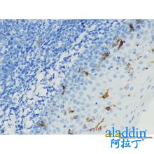 Recombinant CD1a Antibody