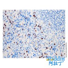 Recombinant Granzyme B Antibody