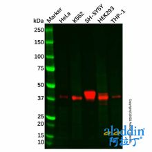 Recombinant Islet 1 Antibody