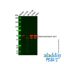 Recombinant KMT5A/SETD8/Pr-SET7 Antibody