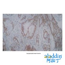 Recombinant MSH2 Antibody