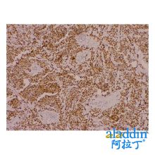 Recombinant Myogenin Antibody
