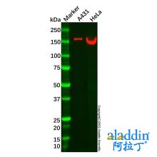 Recombinant NCAPD2 Antibody