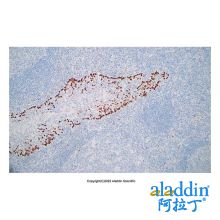 Recombinant p63 Antibody