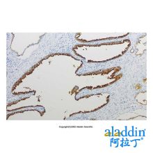 Recombinant PSMA Antibody