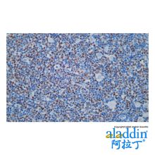 Recombinant SOX11 Antibody