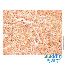 Tyrosinase Mouse mAb