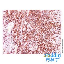 ZAP70 Mouse mAb