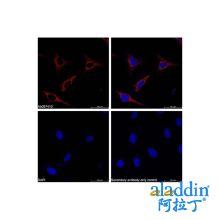 Goat Anti-Rabbit IgG H&L (PE)