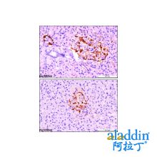 Recombinant GCG Antibody