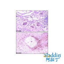 Recombinant Synaptophysin Antibody