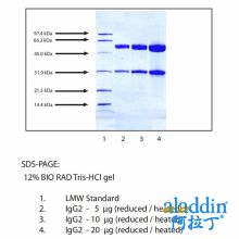 免疫球蛋白G2(IgG2),普通人血浆