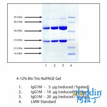 免疫球蛋白G1(IgG1),人骨髓瘤血浆