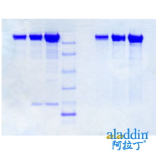 血浆铜蓝蛋白,人血浆