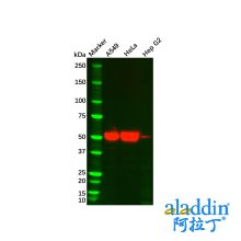 Cytokeratin 7 Mouse mAb