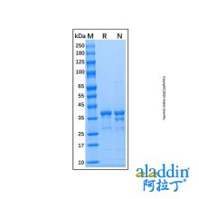 Recombinant Human Arginase 1/ARG1 Protein