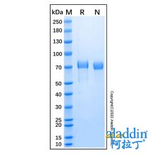Recombinant Human SMPD1 Protein