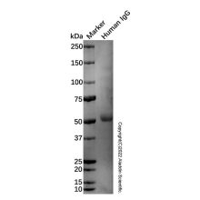 Goat Anti-Human IgG Fc (Alkaline Phosphatase)
