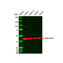 LNCaP Whole Cell Lysate