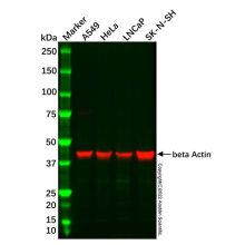 SK-N-SH Whole Cell Lysate